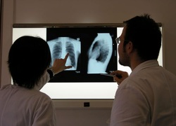 Radiologie, longen