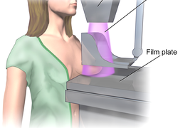 Afbeelding over het maken van een mammogram 
