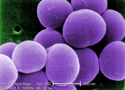 Normal_staphylococcus_aureus_visa