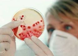 Bacterie-onderzoek