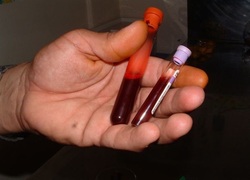 Bloed prikken, bloedonderzoek