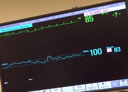 haga ziekenhuis hartmeter