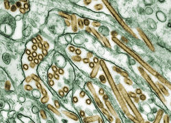Normal_vogelgriep__-c__727px-colorized_transmission_electron_micrograph_of_avian_influenza_a_h5n1_viruses