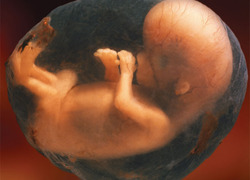 Normal_foetus_amniotic_sac