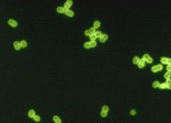 Normal_pneumokok_bacterie_hersenvliesonsteking