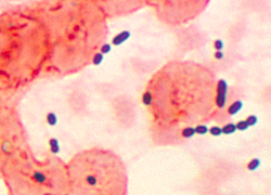 Normal_enterococcus_histological_pneumonia_01