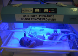 Lichttherapie voor een pasgeboren baby met geelzucht