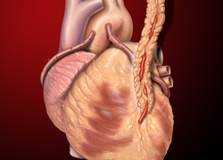 Normal_heart_saphenous_coronary_grafts