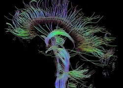 De hersenactiviteit van ongeboren foetussen wordt gemeten met Diffusion Tensor Imaging (DTI), een MRI-techniek waarmee je de verbindingen tussen hersengebieden kan fotograferen door diffusie van watermoleculen te meten. 