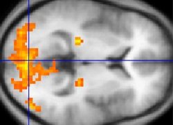 Normal_fmri_analyse_statistiek_hersenen_brain_beeldvormende_techniek_wiki_-c_