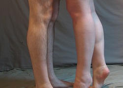Normal_male_and_female_legs