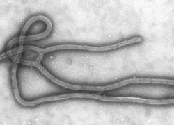 Normal_ebolavirus_ebola_virus