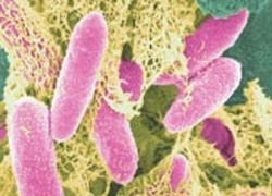 Normal_e-coli-in-color_mrsa_wiki_-c_