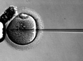 Normal_ivf-_eicel-bevruchting-zwanger-embryo