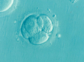 Normal_embryo_ivf