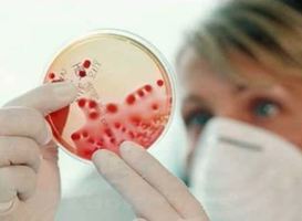 https://www.nationalezorggids.nl/uploads/article/article_image/52317/normal_onderzoek_kweek_virus_bacterie.JPG