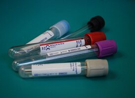 Nederland koopt 1 miljoen testen voor aantonen antistoffen corona in bloed