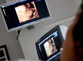 Onderzoek naar meerwaarde 13-wekenecho voor zwangere vrouwen