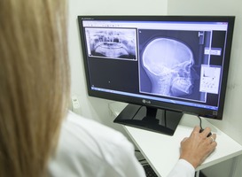 Gebruik Diagnostische Referentieniveaus röntgenonderzoek