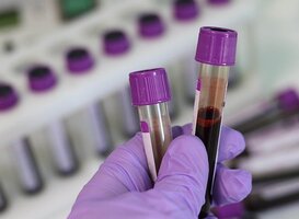 Sanquin verzamelt plasma voor mogelijk geneesmiddel coronavirus