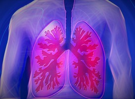 Patiënten met ernstig COPD gebaat bij dagelijkse dosis morfine