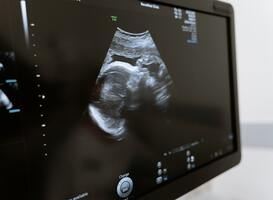 'Laat OM niet meer standaard late abortus onderzoeken'