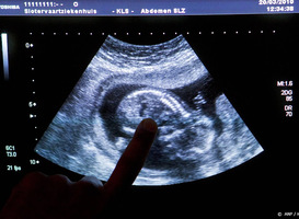 Pro Life stopt met basisverzekering zonder abortus, euthanasie en transgenderzorg