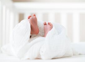 'Mogelijke bijwerking ontdekt bij baby's met aardbeienvlek die bètablokkers kregen' 