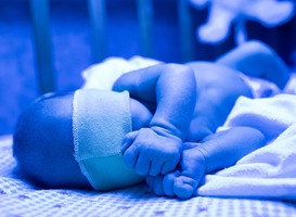 Thuisbehandeling mogelijk voor baby's met geelzicht LUMC en Alrijne 