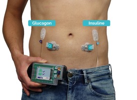 Normal_inreda-ap5-op-lichaam-glucagon-en-insuline-