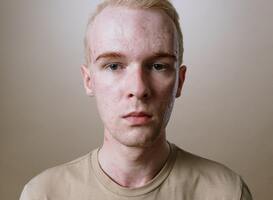 Week van de Huidtherapie 2022 van start