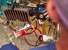 Wereldprimeur Catharina Hart- en Vaatcentrum: nieuwste hart-longmachine